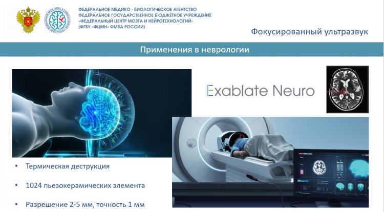 Российские компании готовы развивать технологии сфокусированного ультразвука в медицине
