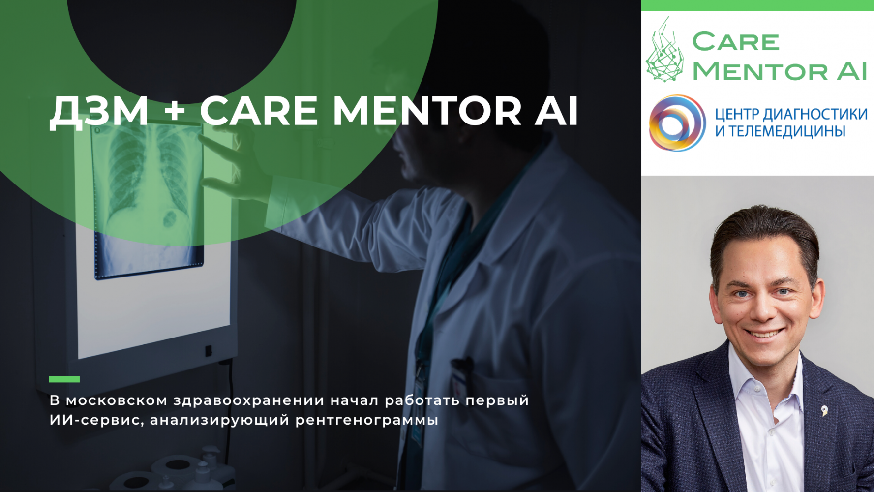 В московском здравоохранении начал работать первый ИИ-сервис, анализирующий рентгенограммы